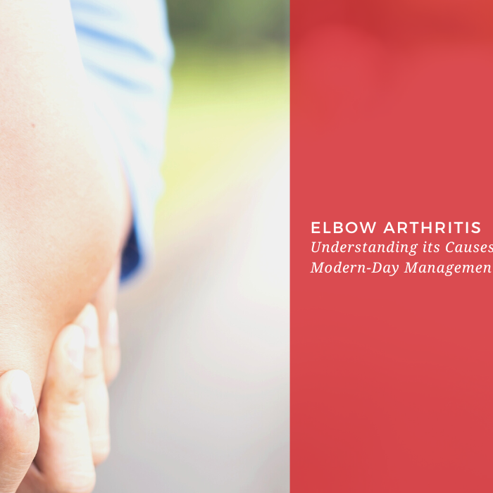 Elbow Arthritis: Understanding its Causes, Symptoms, and Modern-Day Management Techniques