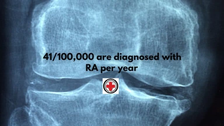 DR. ARTHRITIS SHARES: FINDINGS POINT TO POSSIBLE BREAKTHROUGH IN RHEUMATOID ARTHRITIS TREATMENT - Dr. Arthritis
