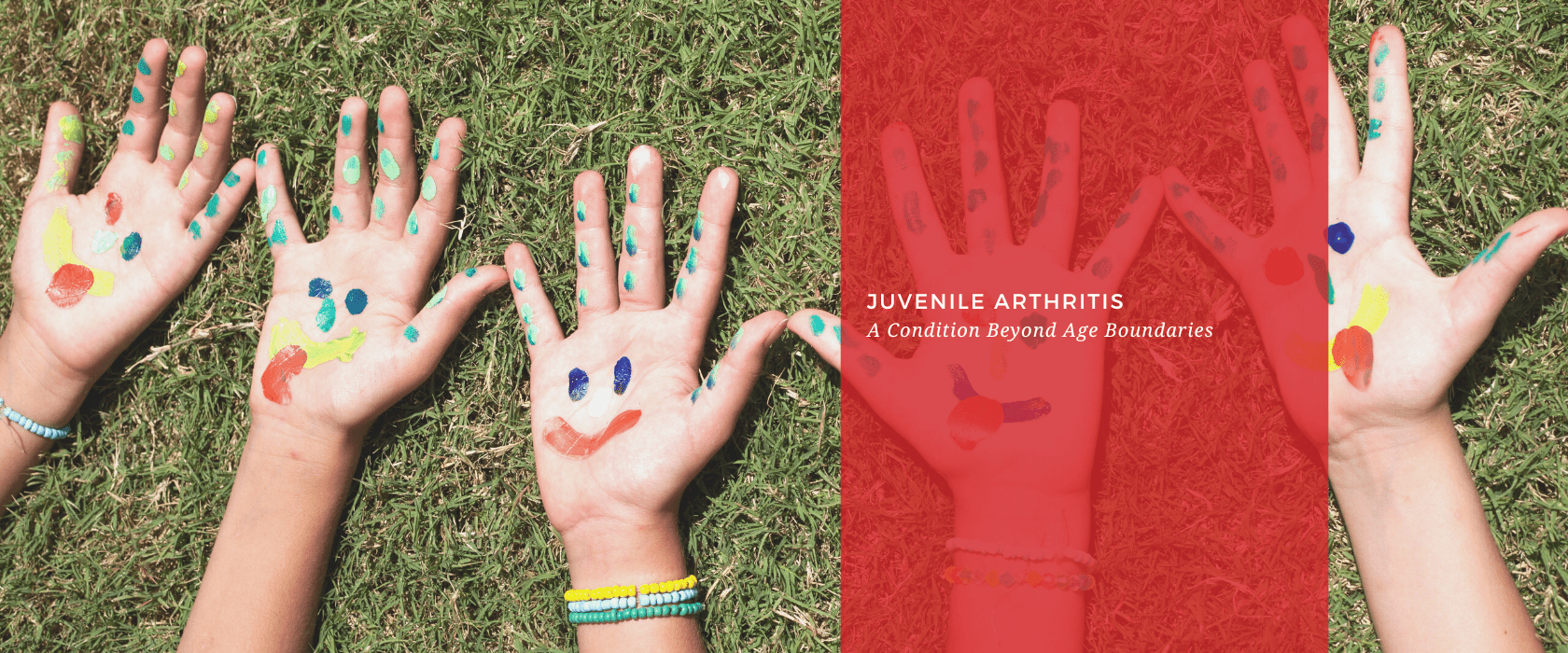 Juvenile Arthritis: A Condition Beyond Age Boundaries - Dr. Arthritis