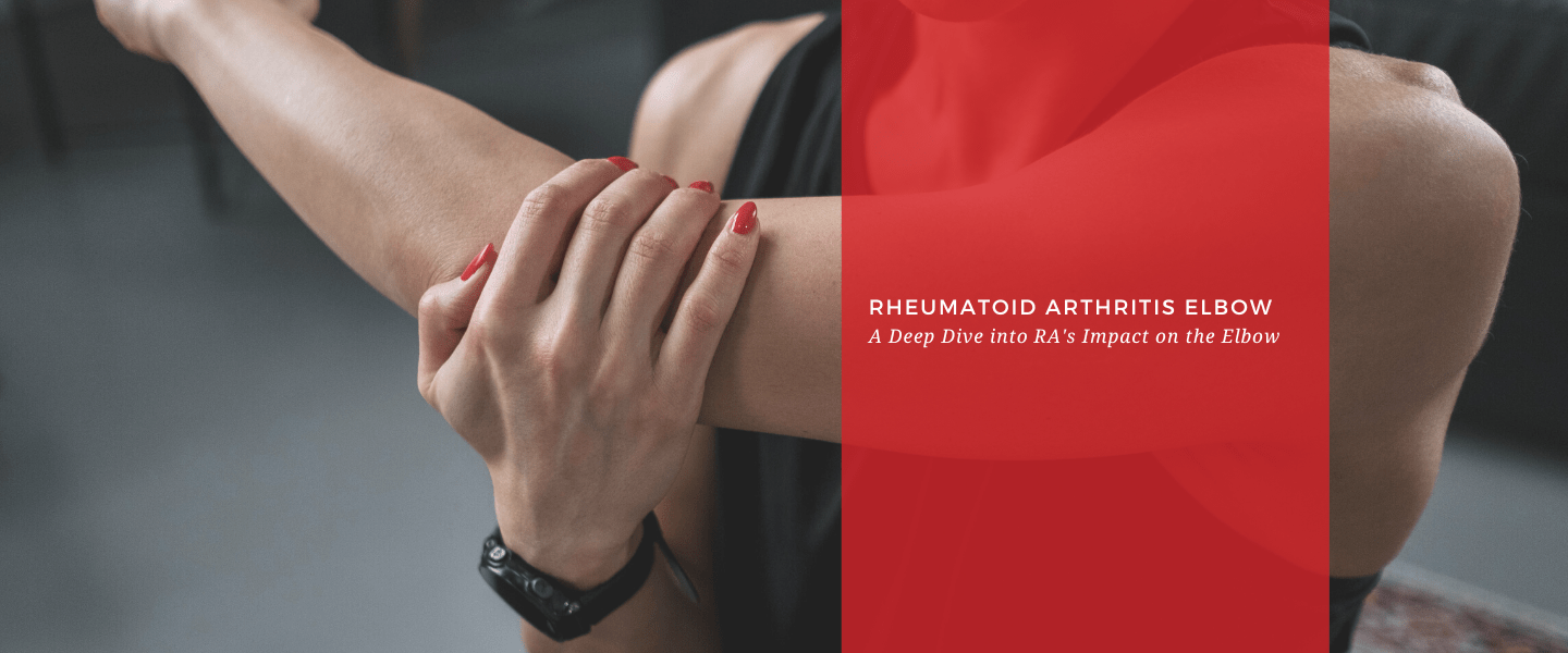Rheumatoid Arthritis Elbow: A Deep Dive into RA's Impact on the Elbow - Dr. Arthritis