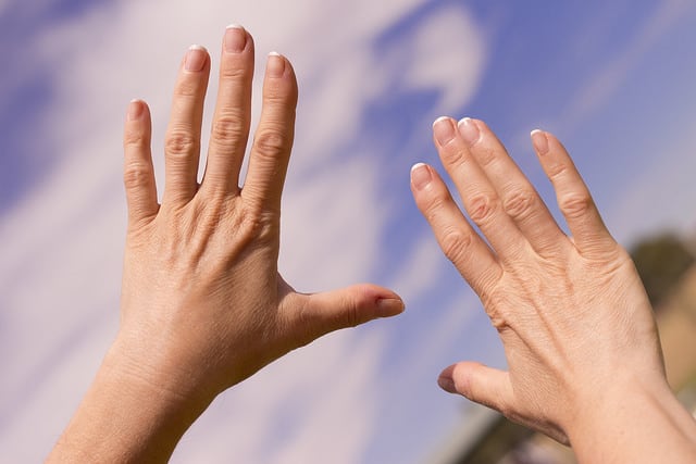 Rheumatoid Arthritis Gets Misdiagnosed All Too Often - Dr. Arthritis