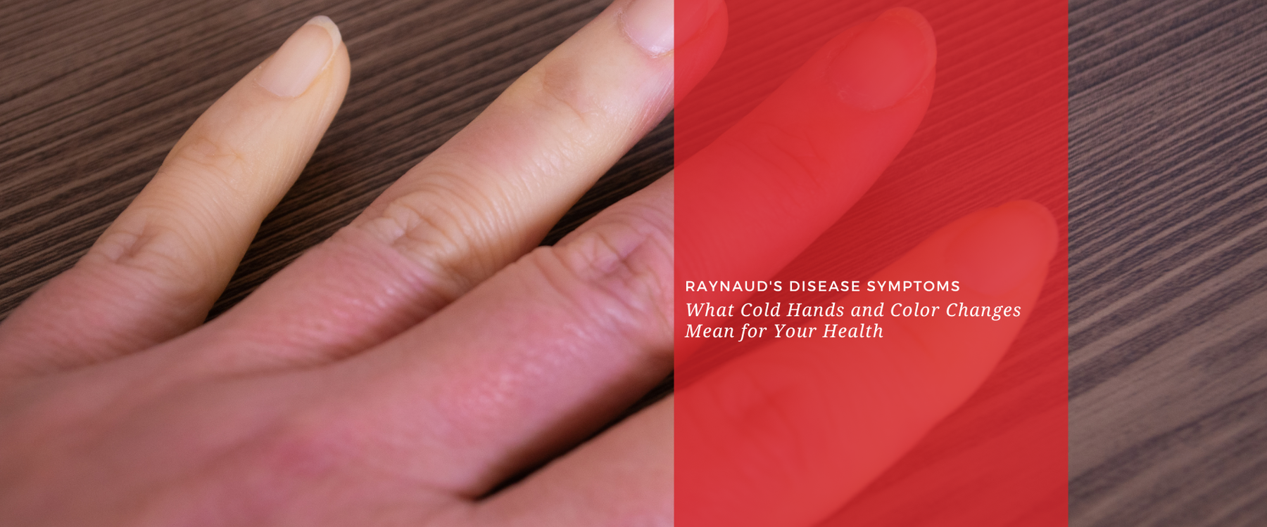 Raynaud's Disease Symptoms: What Cold Hands and Color Changes Mean for Your Health