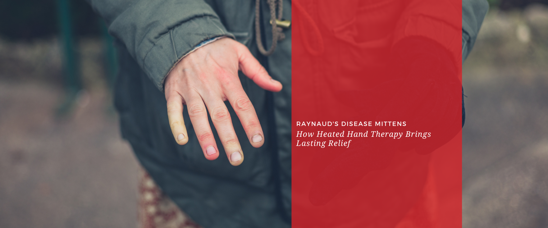 Raynaud's Disease Mittens: How Heated Hand Therapy Brings Lasting Relief