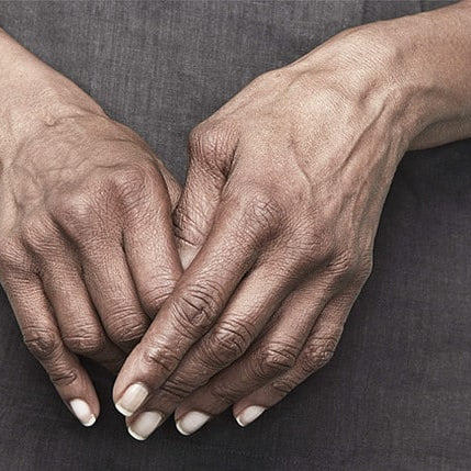 DR. ARTHRITIS EXPLAINS: THE MOST COMMON ARTHRITIS MYTHS EXPLAINED - Dr. Arthritis