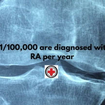 DR. ARTHRITIS SHARES: FINDINGS POINT TO POSSIBLE BREAKTHROUGH IN RHEUMATOID ARTHRITIS TREATMENT - Dr. Arthritis