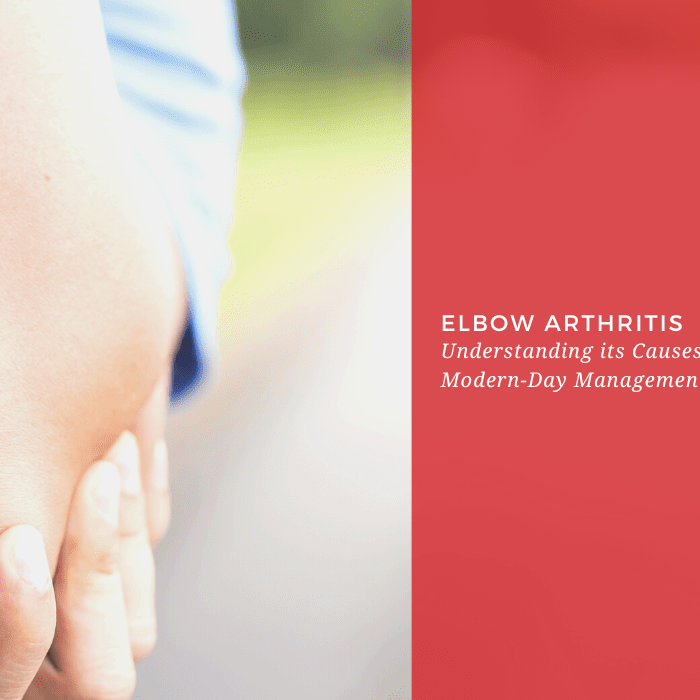 Elbow Arthritis: Understanding its Causes, Symptoms, and Modern-Day Management Techniques - Dr. Arthritis