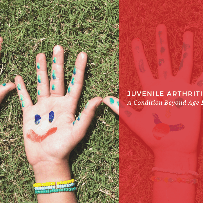 Juvenile Arthritis: A Condition Beyond Age Boundaries - Dr. Arthritis