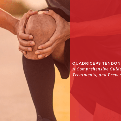 Quadriceps Tendonitis: A Comprehensive Guide to Causes, Treatments, and Prevention - Dr. Arthritis